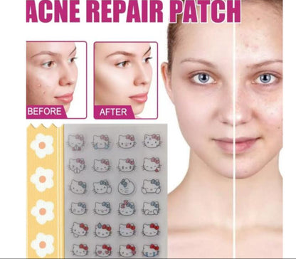 PARCHE PARA ACNE HELLO KITTY